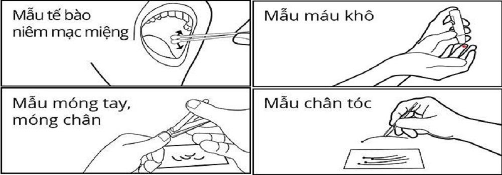 Bảng giá Xét nghiệm sàng lọc trước sinh không xâm lấn NIPT, Bảng giá Xét nghiệm sàng lọc trước sinh không xâm lấn NIPT